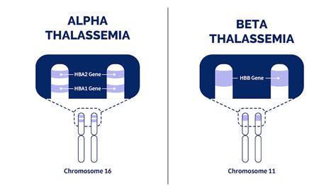 what is beta thalassemia|Beta Thalassemia: What You Should Know .
